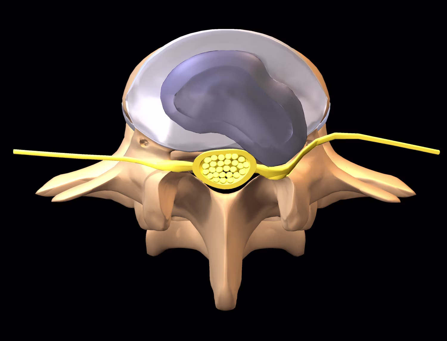 Et bilde av prolaps.